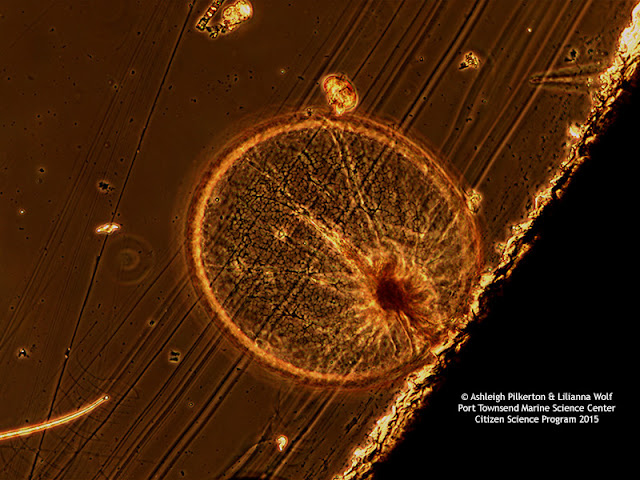 Dinoflagellate under the microscope.
