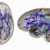 Great Graphic:  Neural Networks in Men and Women