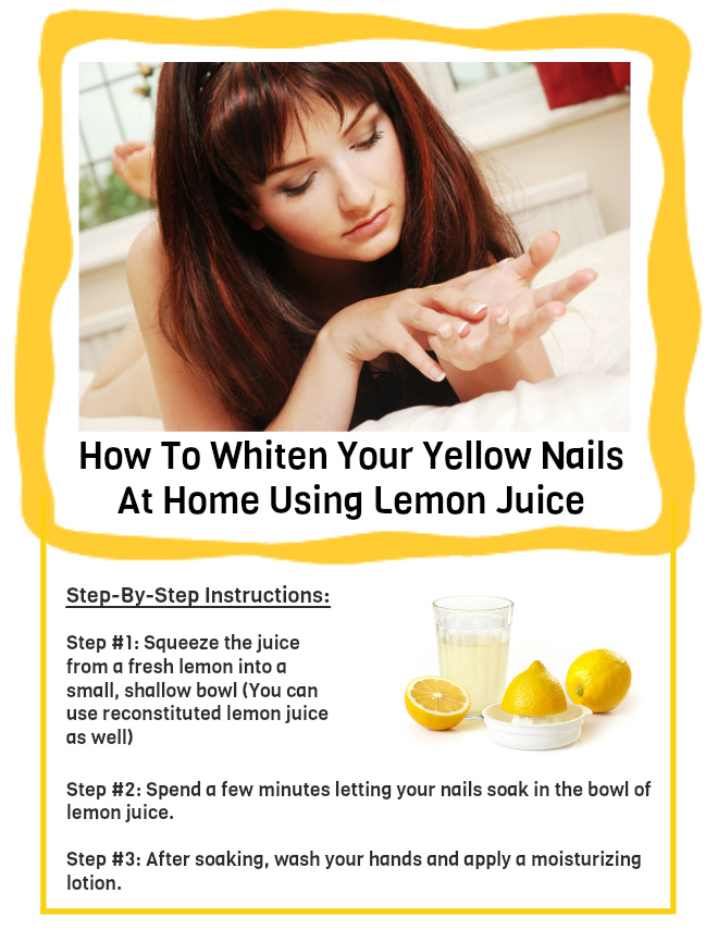 Health & nutrition tips How To Whiten Your Yellow Nails At Home
