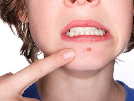Health beauty la tónica que limpia para las caras las revocaciones