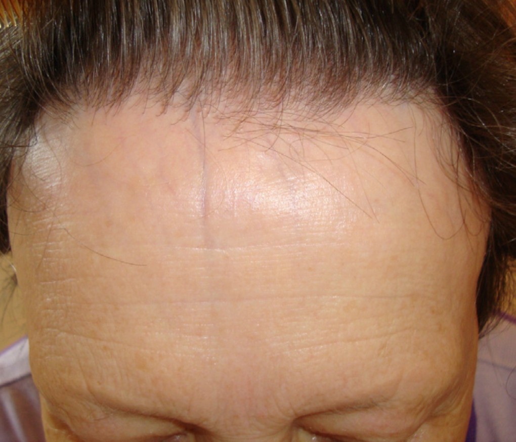 El aceite marokko el cabello