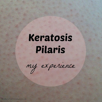 Chicken Skin, Keratosis Pilaris, KP, skincare