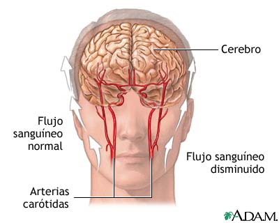 arterias cerebrales