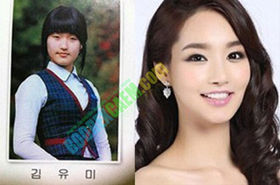 arsip-artikel-unik.blogspot.com - Foto Wajah Kim Yu-mi Pemenang Miss Korea 2012 Hasil Operasi Plastik