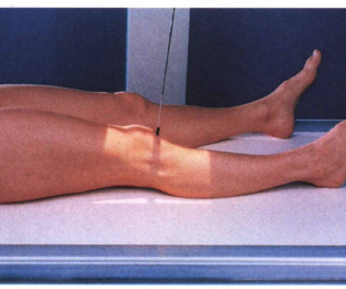 Ap Projection Knee Radtechonduty