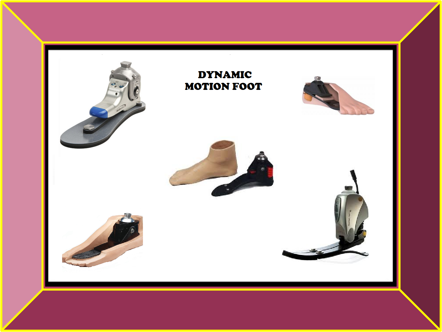 Prosthetics & Orthotics from My Care April 2014