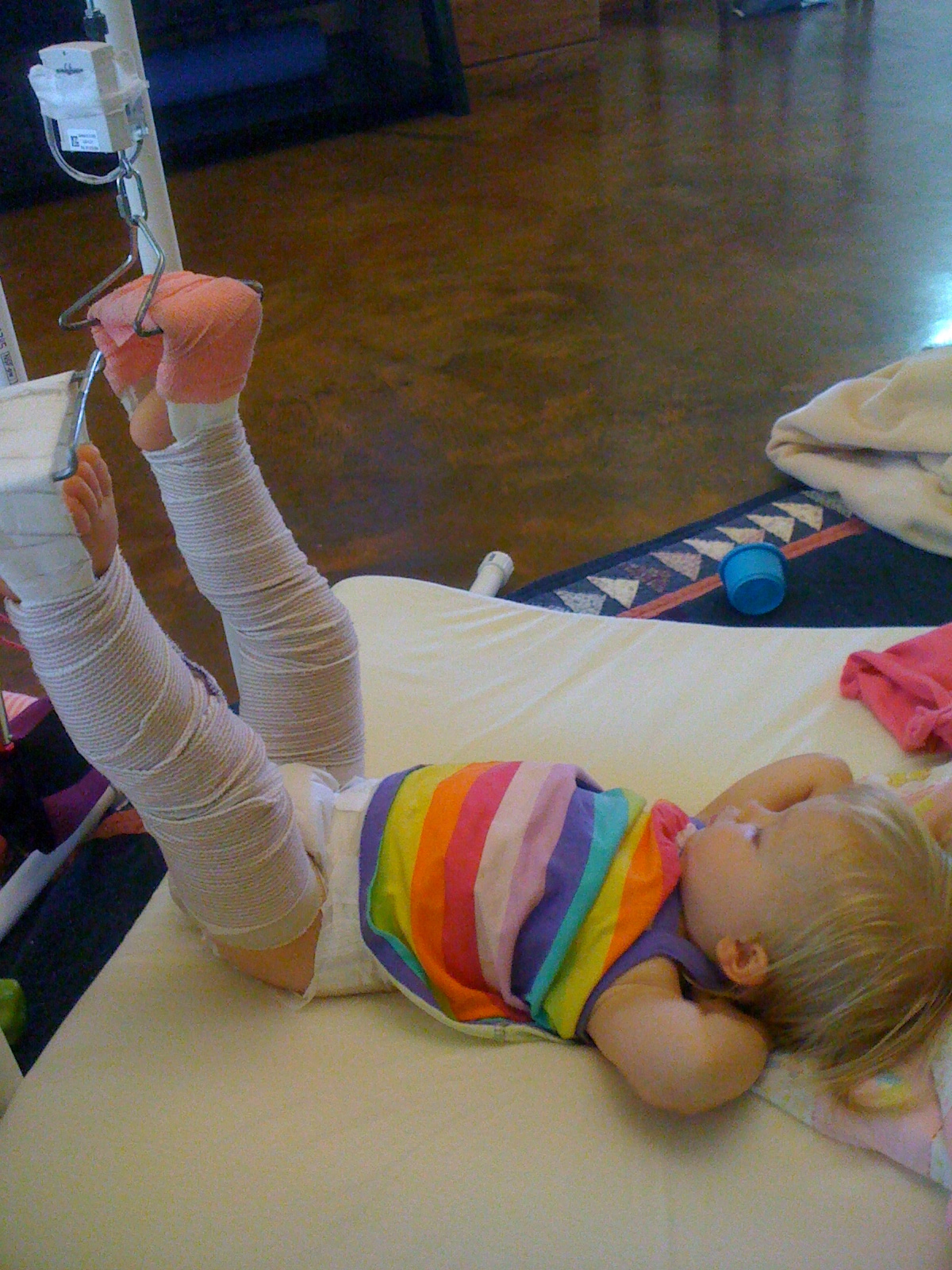 Cameron's Hip Dysplasia Story Cameron's Month in Bryant's Traction