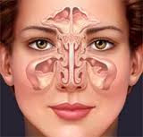 Para nasal sinuses