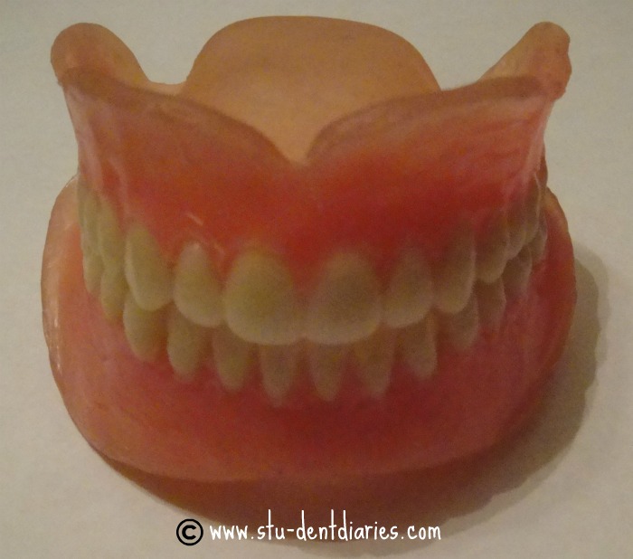 StuDENT Diaries Removable Prosthodontics Complete Dentures