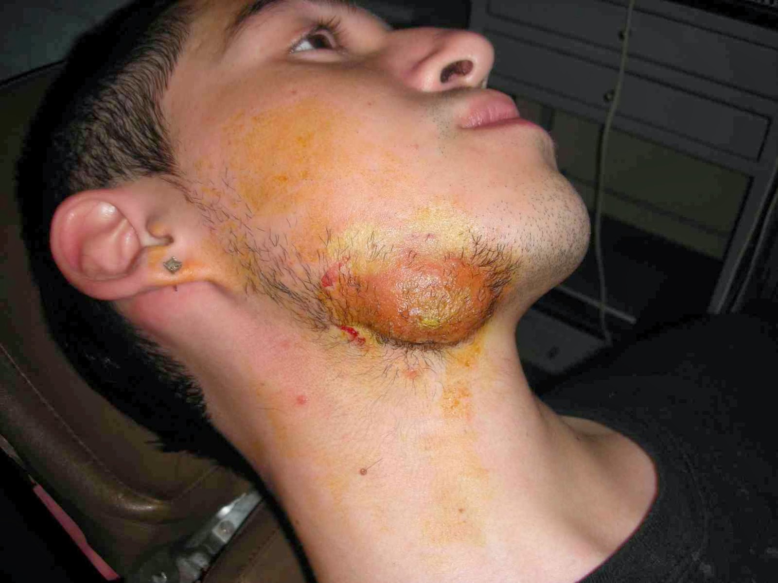 Como evitar los golondrinos en las axilas_3