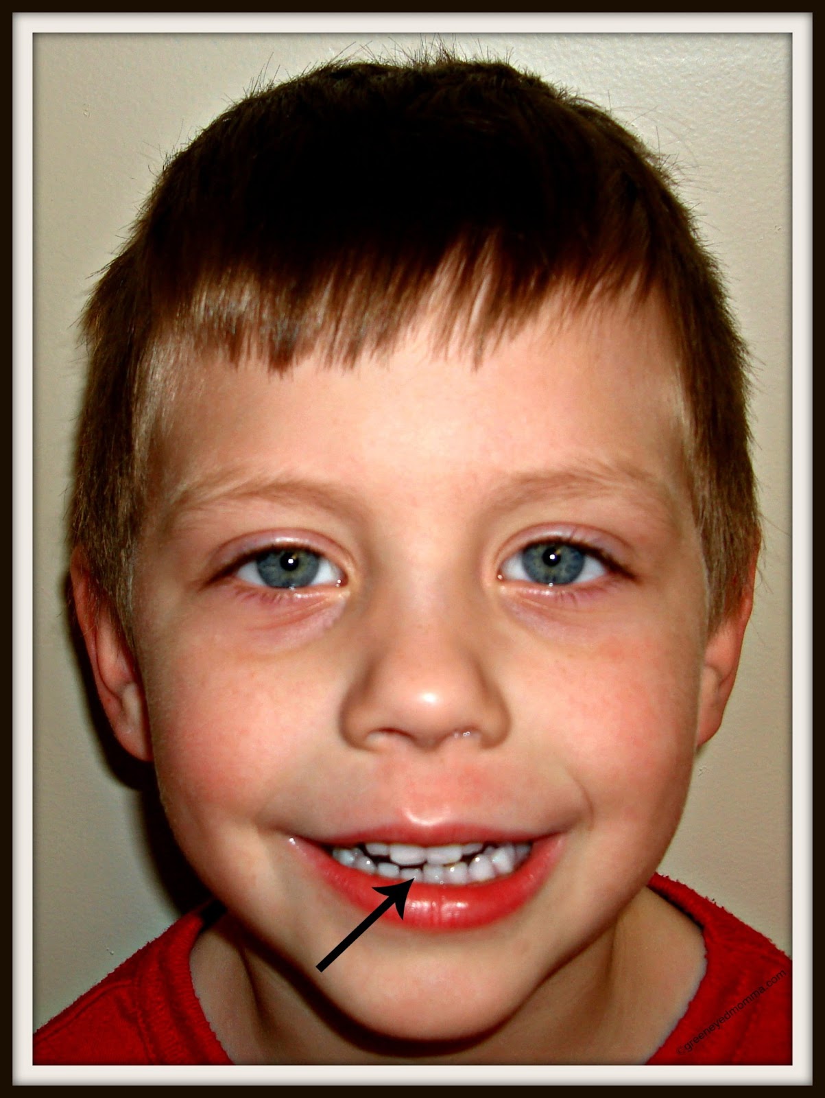 Wordless Wednesday Wiggly Tooth