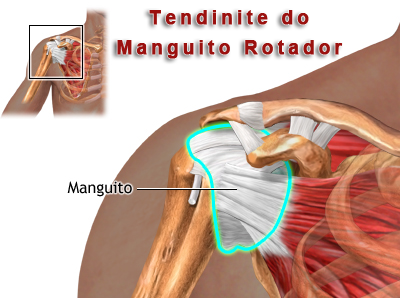 Tratamento de dores e doenças articulares