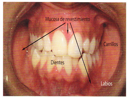 vestibulo oral que es radicales libres aparato digestivo vestibulo oral que es radicales libres aparato digestivo