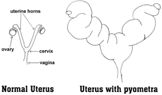 Hình trái, tử cung bình thường. Hình phải,  tử cung bị viêm. Ảnh đại diện.