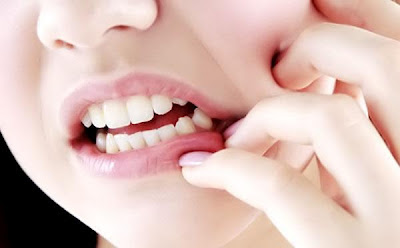 Cara Mengobati Sakit Gigi Berlubang 
