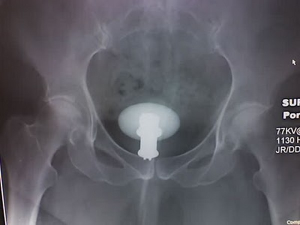 Теща выбрила растраханную вагину фото