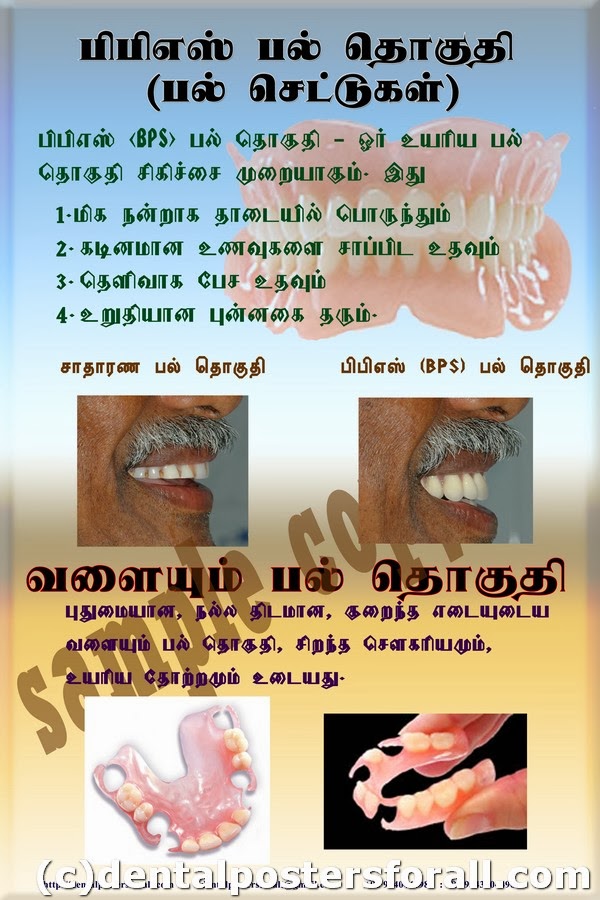 Dental Posters to Educate Patients