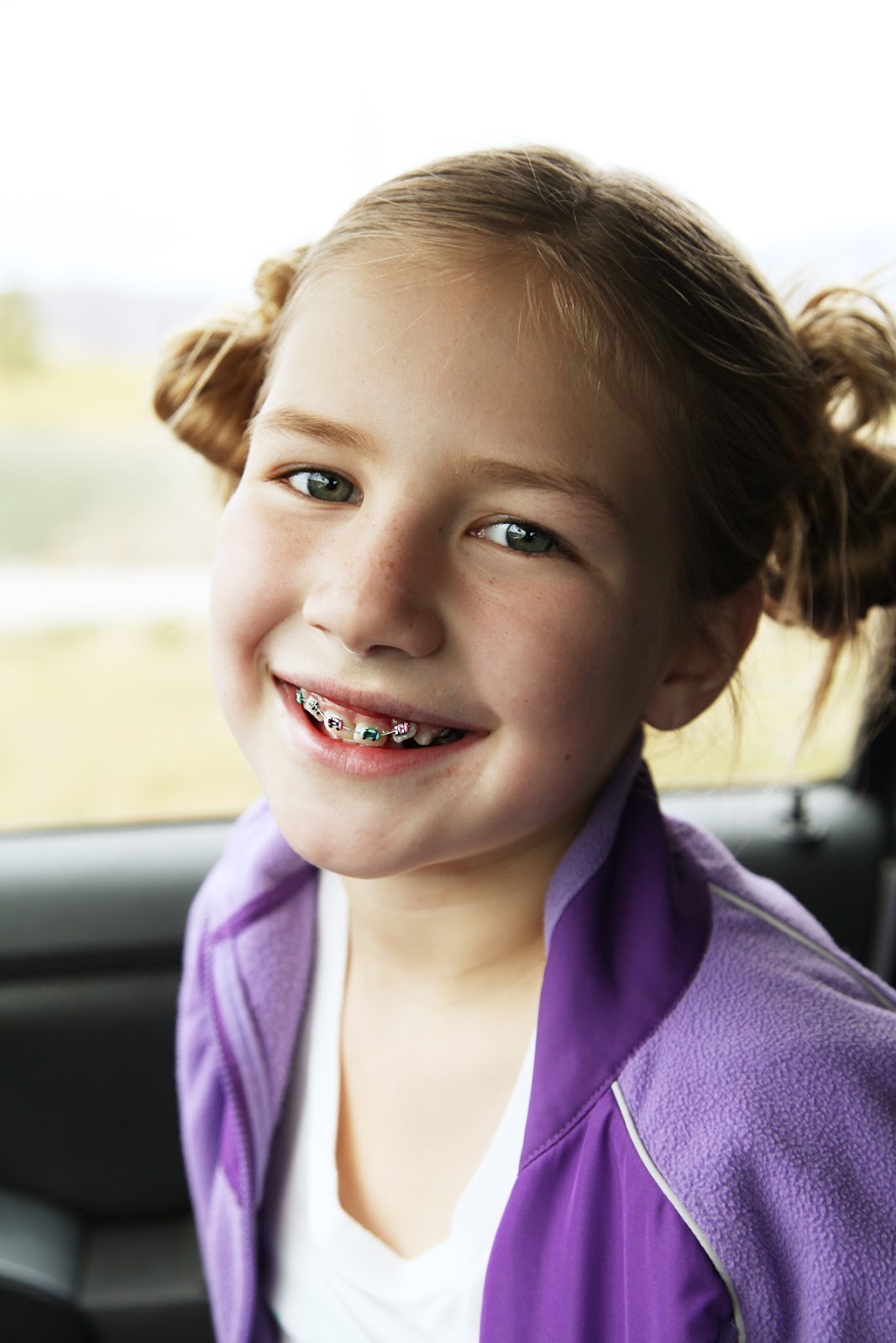 The Lighten Family Blog BraceFace