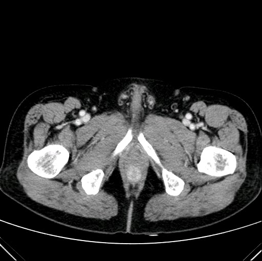 spasm of anus itty bitty titty orgy