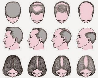 Hair Treatment Clinic Reasons For Hair Loss