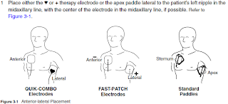 paddles defibrillator biomedical engineer paddle electrodes whether depend obese patient thin fat location body diagram