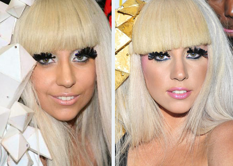 Lady Gaga Plastic Surgery on Chatter Busy  Lady Gaga Plastic Surgery