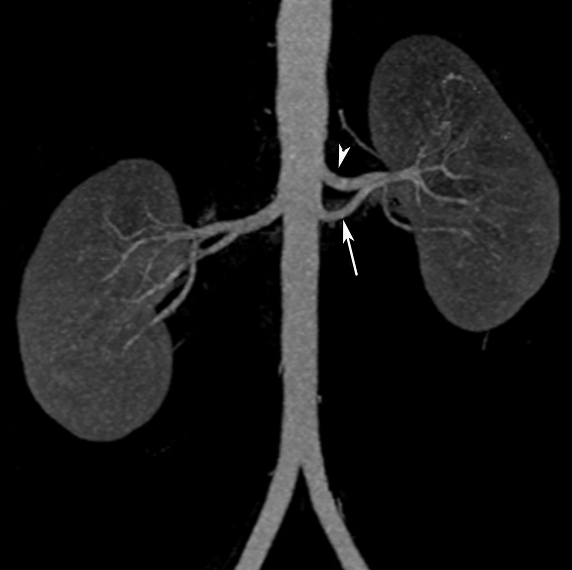 Radiodiagnosis Imaging is AmazingInteresting cases Renal artery