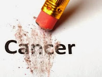 Ini Faktor Yang Menyebabkan Timbulnya Sel Kanker