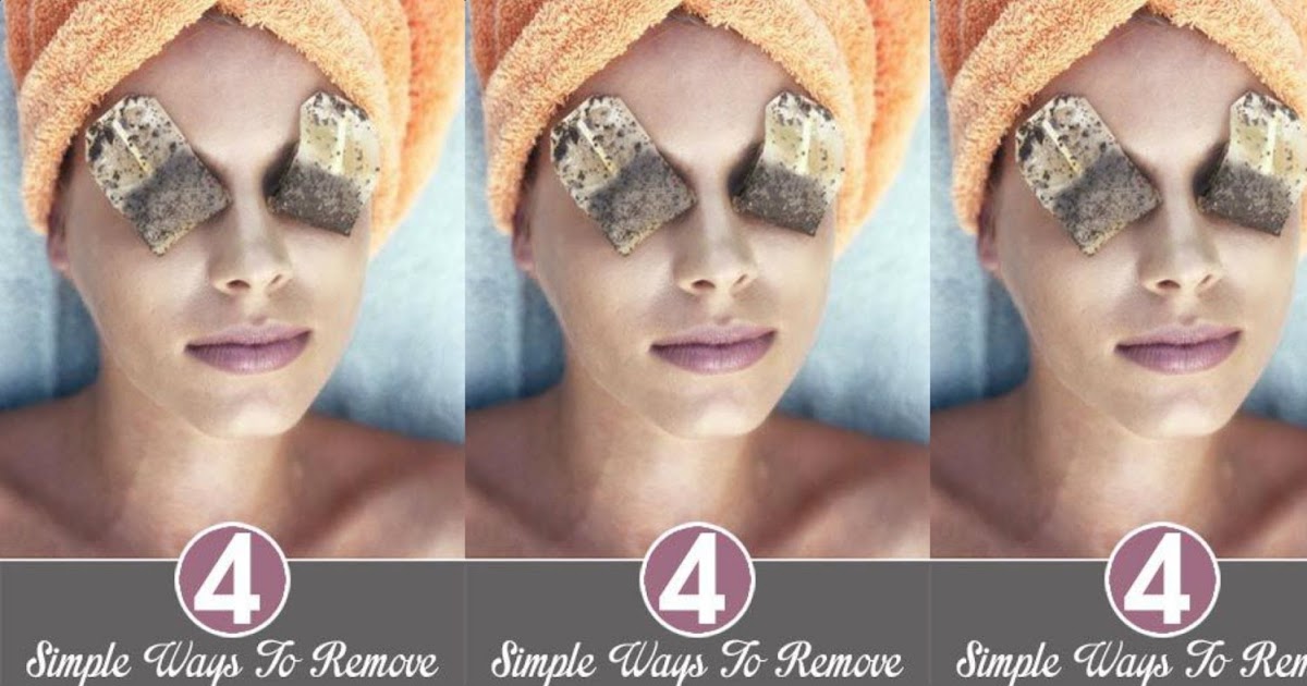 4 Simple Ways To Remove Dark Circles Completely | Tips Webs