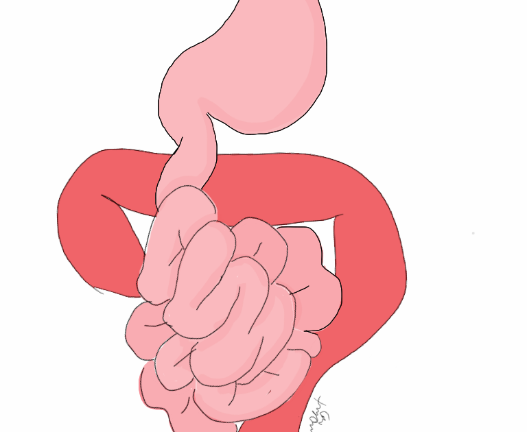 Pediatric Surgery Zone What is the normal length of small bowel in a