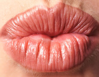 Chapped Lips Images