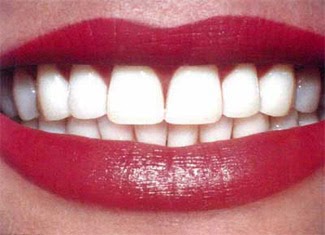 teeth clean stains smokers health very