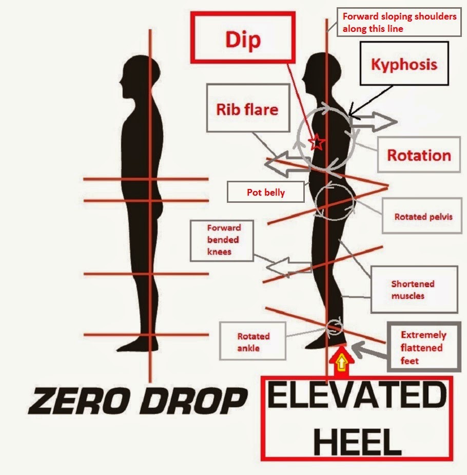 Posture Diagram