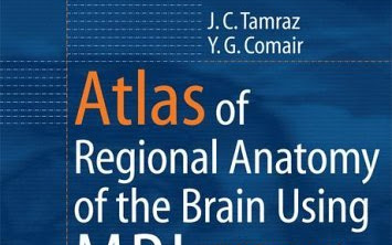 Atlas Giải phẫu MRI Não định khu với Liên quan chức năng