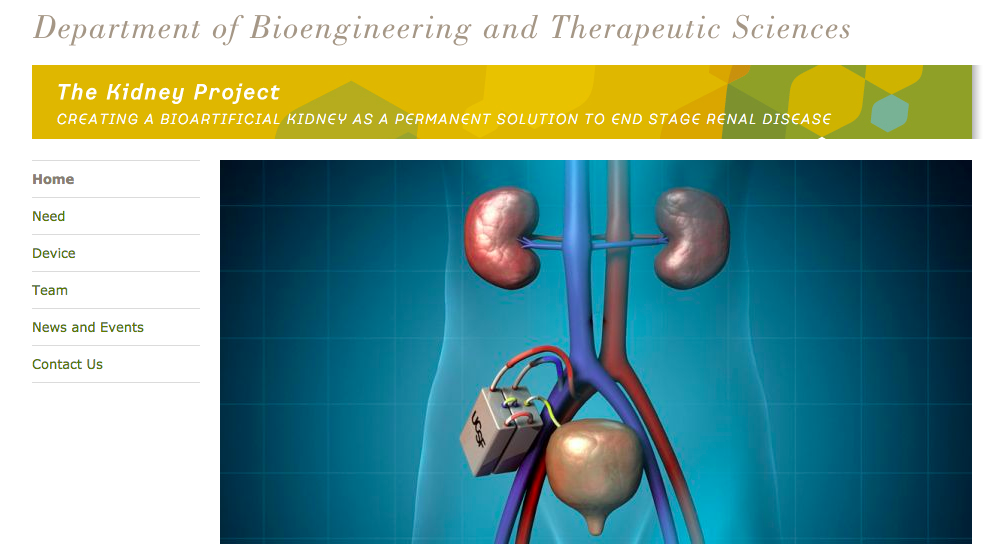 Genomic Entertainment The Kidney Project At UCSF