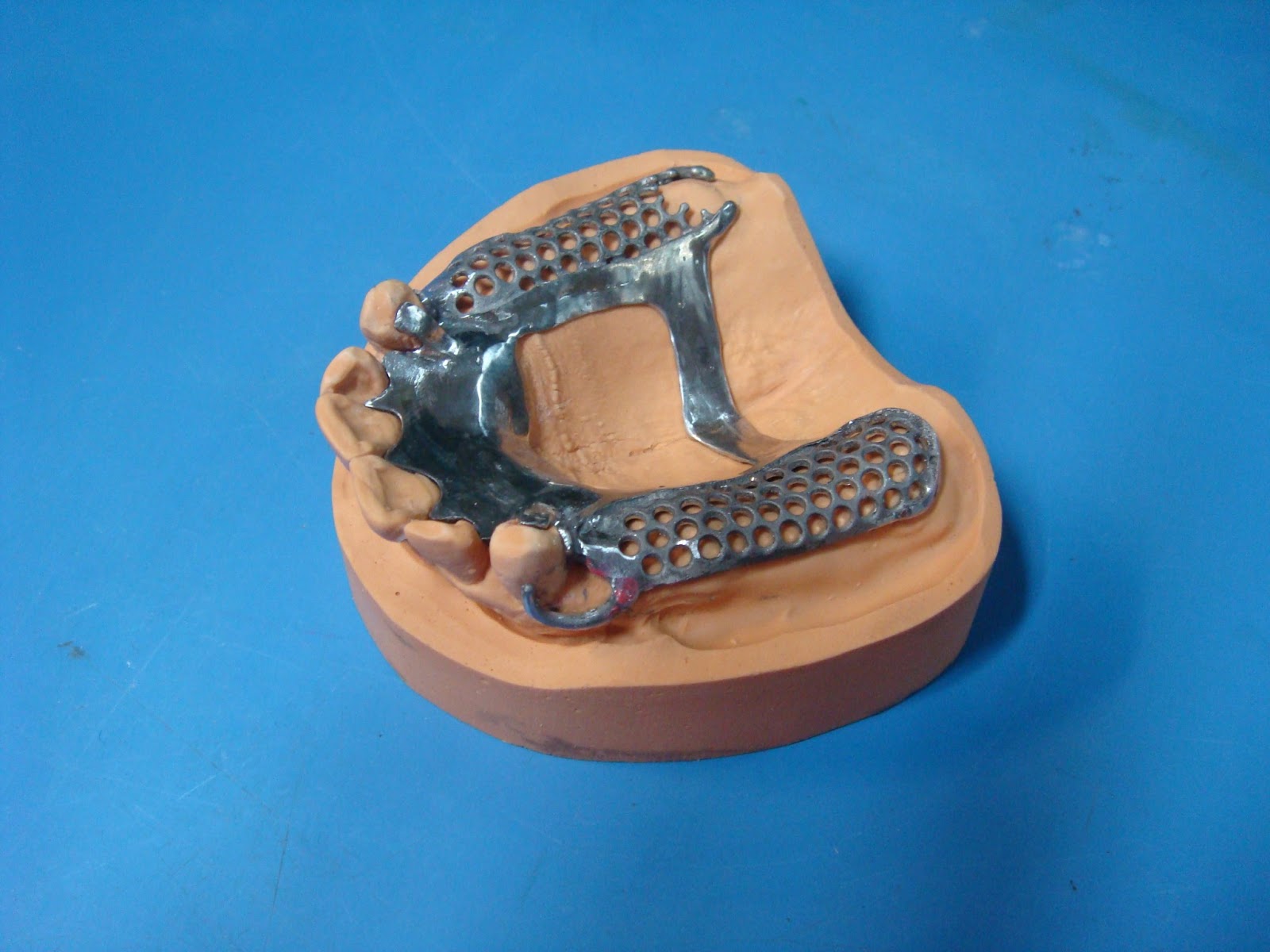 Step by step Guide for Understanding the Prosthodontics A step by step procedure in Cast