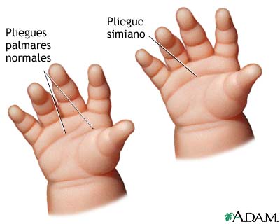 Respostas a exoferta para aumento no membro