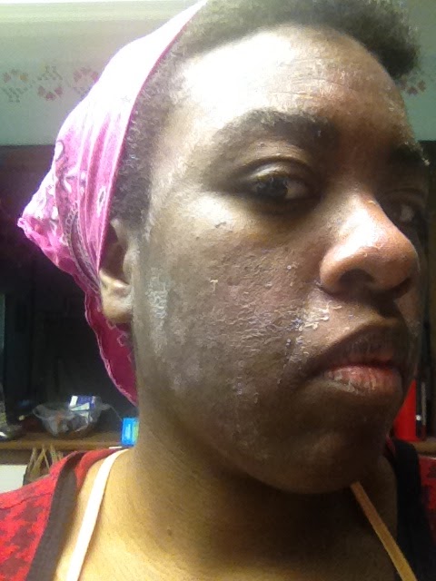 Laurel S Blog Warning The Famous Proactiv Skin Cleanser Ruined My Skin
