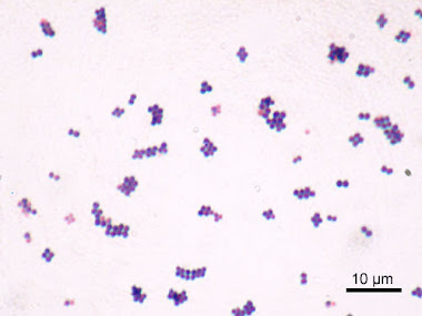 Tinción de gram ( STHAPHYLOCOCCUS AUREUS)