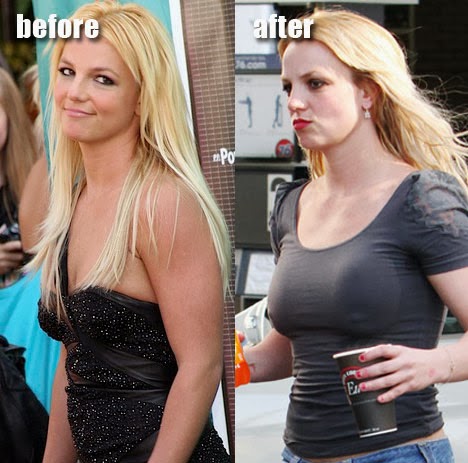 Britney Spears Plastic Surgery Nose Jobs, Boob Jobs Before ...