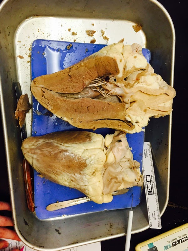 Anatomy and Physiology : The Heart Dissection