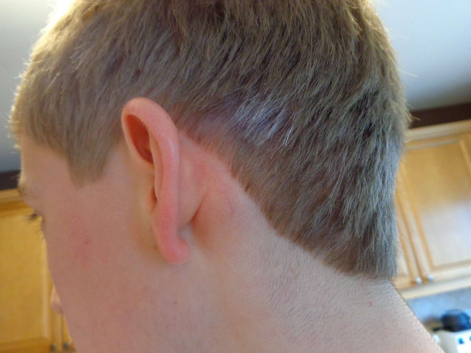 Surviving Orthognathic Surgery 2014