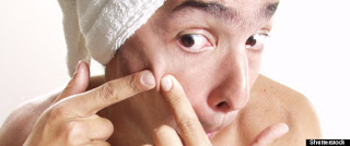 Pimple Popping: acné, des cloques et des croûtes - 9 choses que vous ne devriez pas Pop