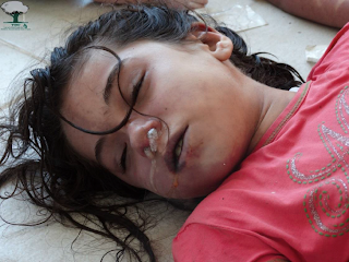 Un enfant victime des armes chimiques lors de l'attaque du 21 août 2013 de Ghouta (Damas, Syrie).