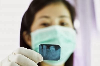 Teeth Implants Surgeons