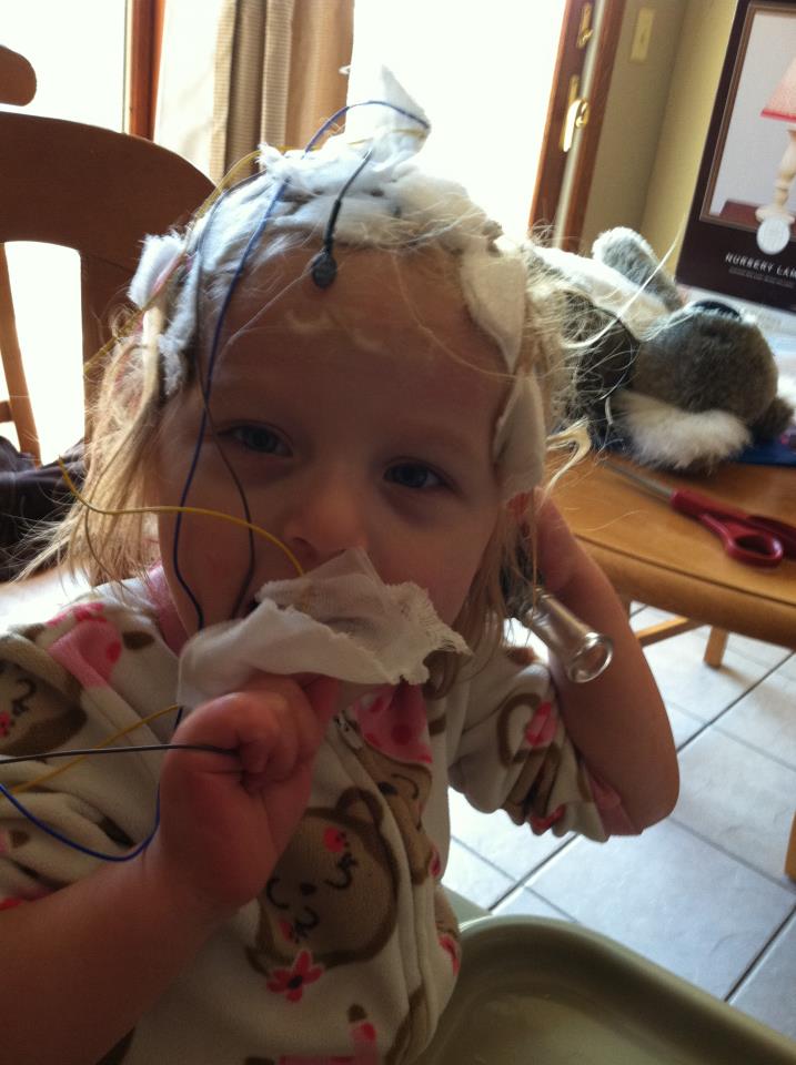 Angelman Syndrome Maisie 24 Hour EEG