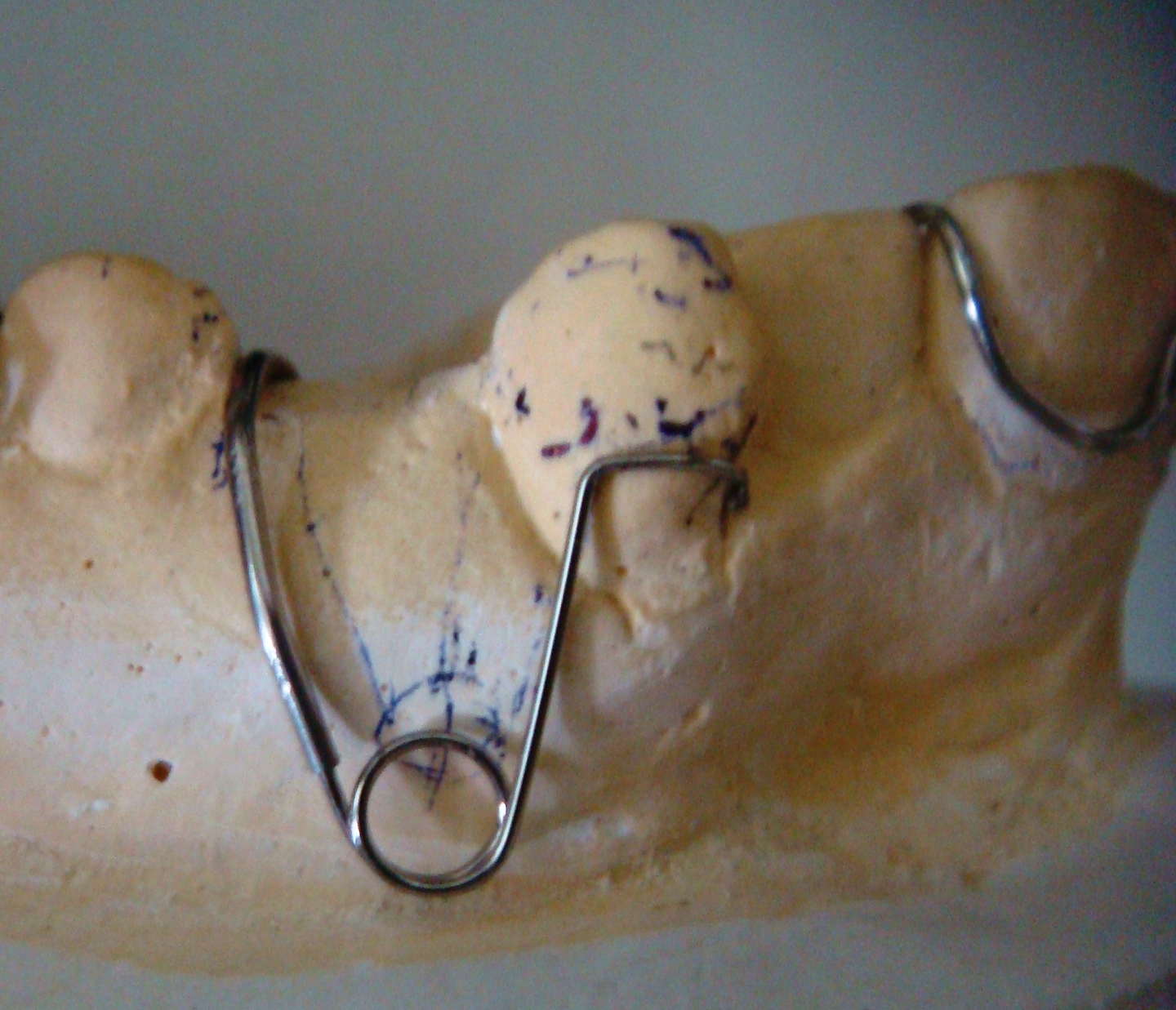 Dentistry lectures for MFDS/MJDF/NBDE/ORE A Note on Active Components