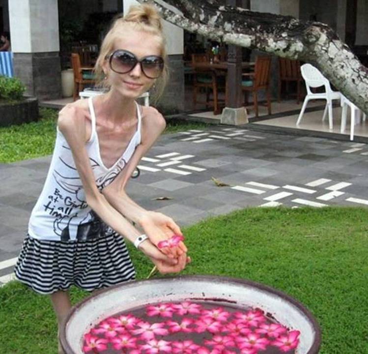 The world&rsquo;s 10 thinnest people