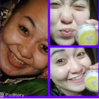 Bukti dan Testimoni Cream Pemutih Wajah Florin Skin Care Paket Normal Bukti dan Testimoni Cream Pemutih Wajah Florin Skin Care Paket Normal