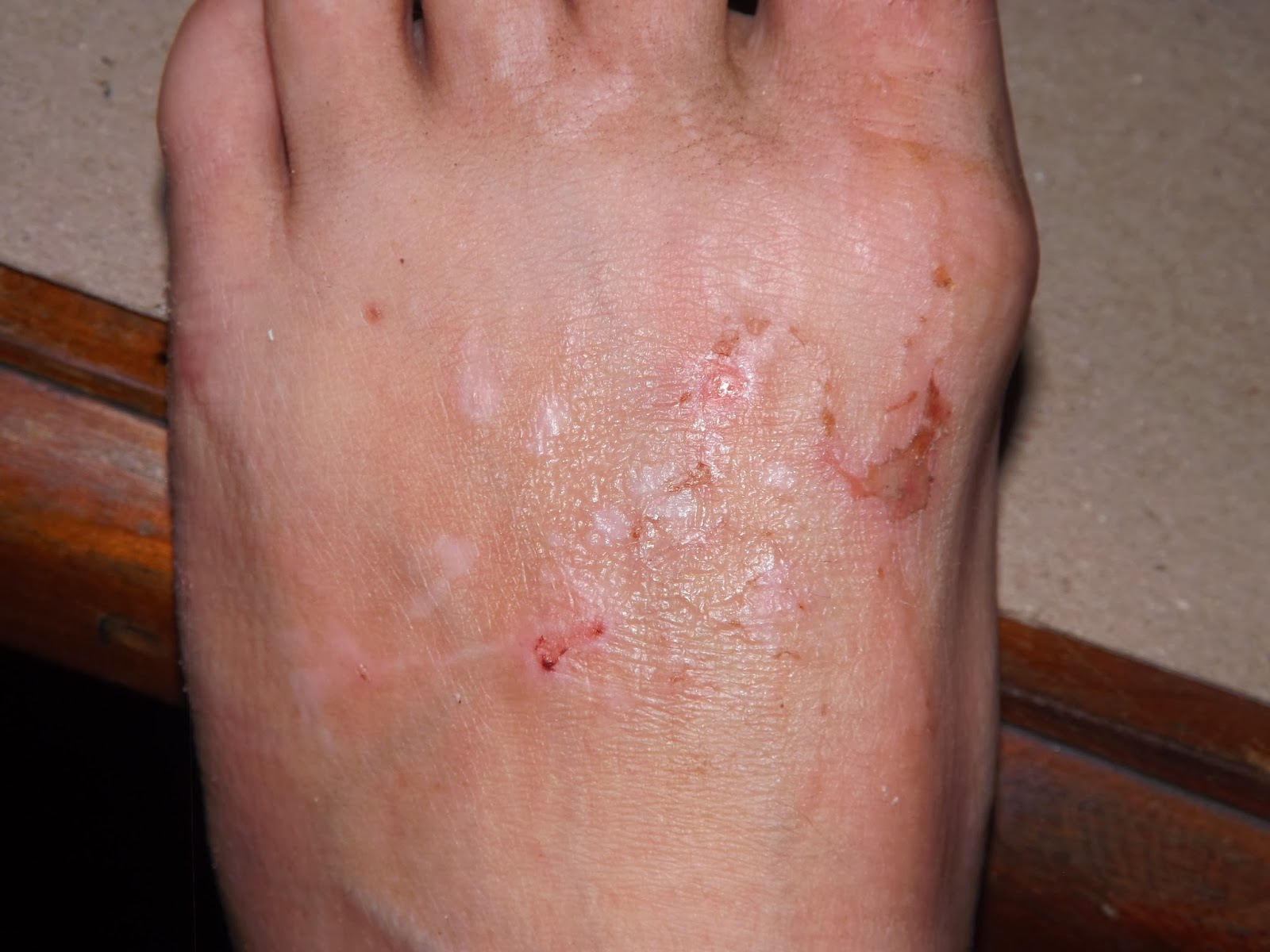 Living in Dakar It's What!!!